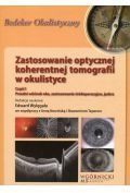 Zastosowanie optycznej koherentnej tomografii w okulistyce. część 1